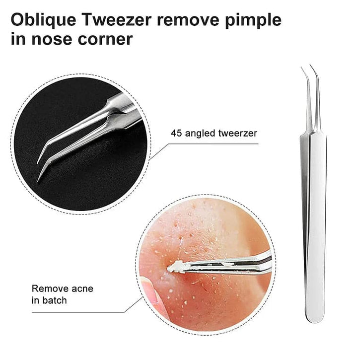 Acne Blackhead Removal Tool Kit